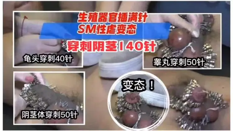 重口变态系列。。胆小勿进，生殖器官被插满针，SM性虐变态穿针140针